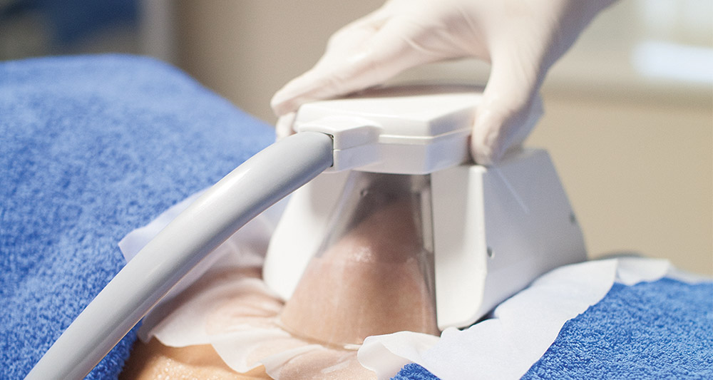 How Fat Freezing and HIFU Work Together? 2 Multiple Areas in One Session HIFU and Fat Freezing Newmarket
