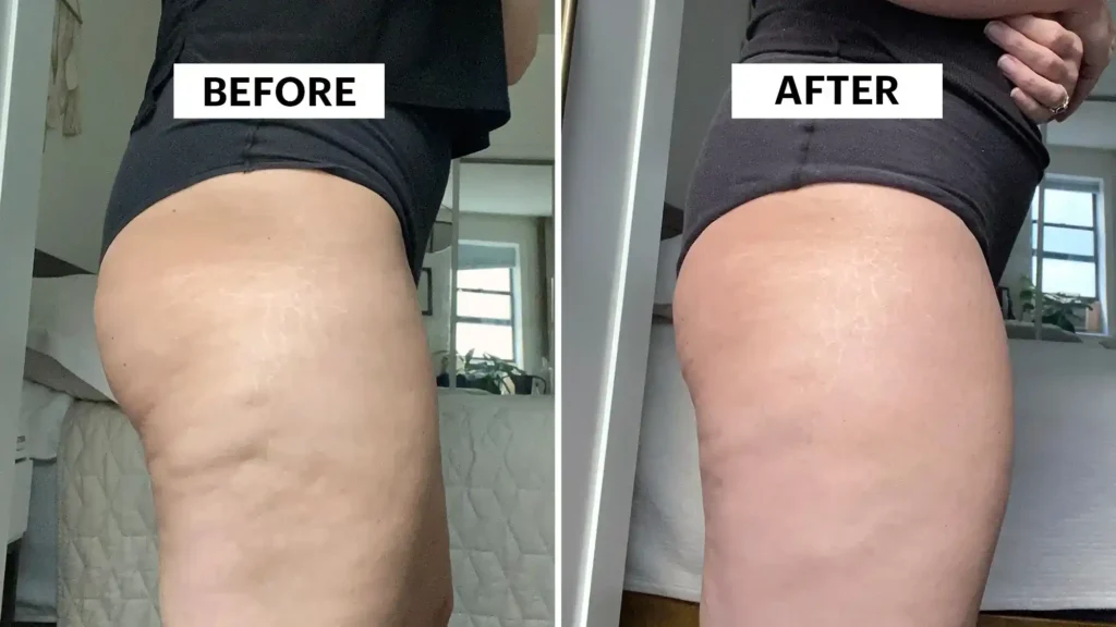 Do Toning Exercise Newmarket Really Tackle Cellulite?
