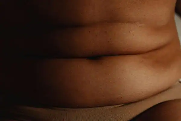 The Hidden Connection: How Stress Shapes Your Fitness and Body Composition 3 image of what stress can do on the stomach area and how Lipo 360 Newmarket can help to change your body shape.